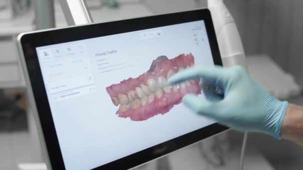 O médico examina o modelo 3D da mandíbula. Um dentista examina uma imagem digital dos dentes em um monitor. Tecnologias modernas em medicina e odontologia — Vídeo de Stock