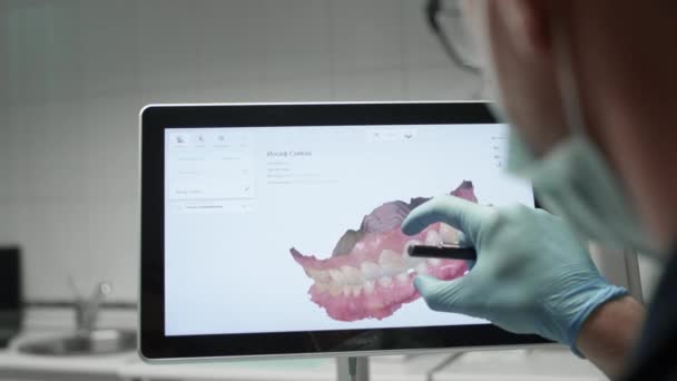 Doktor çenenin üç boyutlu modelini inceliyor. Bir dişçi monitörde dişlerin dijital görüntüsünü inceler. Tıp ve diş hekimliğinde modern teknolojiler — Stok video