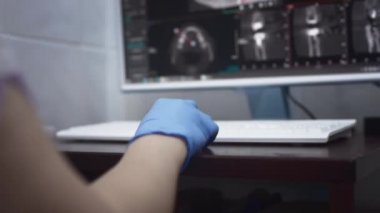 Dişçi bir bilgisayar ekranında çenenin panoramik röntgenini inceliyor. Modern bir diş kliniğinde diş tanılama ekipmanları.