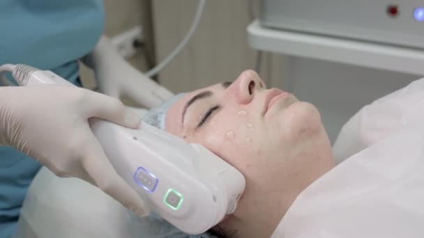 Procedura cosmetica sulla pelle femminile del viso. Sollevamento non chirurgico delle rughe. Il terapeuta fa un lifting al plasma a una cliente donna. — Video Stock