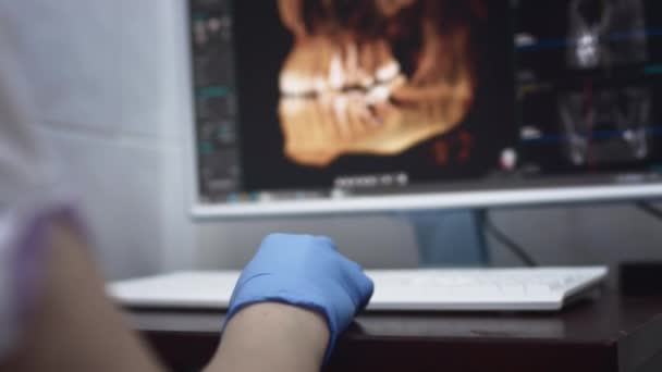 El médico dentista examina una radiografía panorámica de la mandíbula en una pantalla de computadora. El médico muestra un modelo 3D de la boca de los pacientes, resonancia magnética — Vídeos de Stock