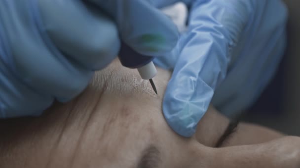 El cosmetólogo realiza el procedimiento Microdermoabrasión de la piel facial de una mujer real — Vídeos de Stock