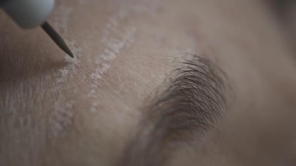 Mujer paciente en el médico dermatólogo cosmetólogo. Suaviza las arrugas de la frente con crioplasma y cirugía de coagulación con argón — Vídeos de Stock