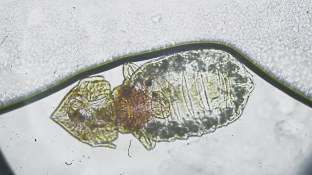 Hoofdluis onder de microscoop. Huidvlo onder vergroting. Het insect in het haar van het lichaam drinkt het bloed. Kevers bij dieren — Stockvideo