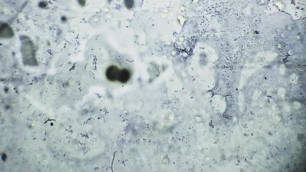 Abstracte bacteriën en microben onder de microscoop. Schimmel of schimmel wordt onderzocht in een wetenschappelijk laboratorium. Veterinaire kliniek, dierziekten — Stockvideo