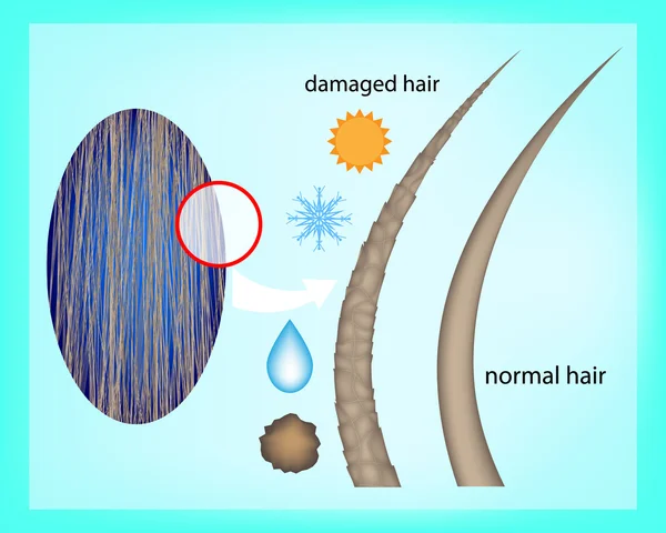 Factores internos y externos que afectan la salud del cabello. Cuidado médico del cabello. Antes y después del tratamiento capilar. Concepto de cuidado del cabello. Cabello dañado y cabello normal — Archivo Imágenes Vectoriales