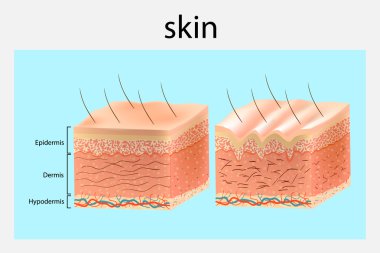 The structure of the skin. Younger skin and aging skin. Vector diagram clipart