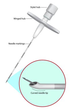 Tuohy Epidural İğnesi. Epidural yönetim