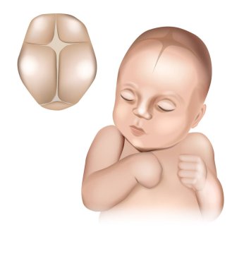 Bıngıldakları doğumda gösteren gerçekçi bir bebek kafası çizimi. Kafatası dikişleri ve bıngıldakları.
