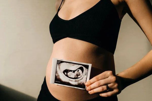 Zwangere Vrouw Met Embryo Echografie Beeld Voorkant Van Haar Buik — Stockfoto