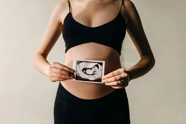 Zwangere Vrouw Met Baby Echografie Beeld Voorkant Van Haar Buik — Stockfoto