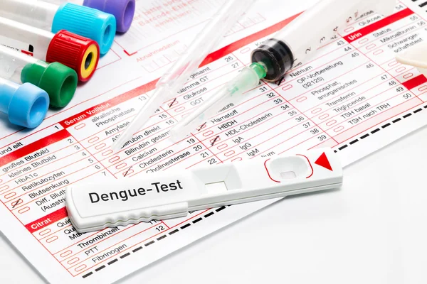 Drug Quick Test — Stock Photo, Image