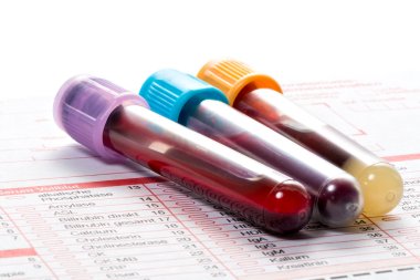 Blood test, blood samples on a laboratory form clipart