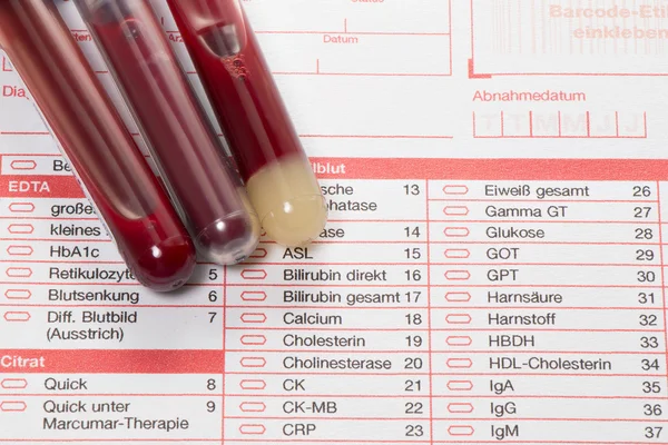 Análisis de sangre, muestras de sangre en forma de laboratorio — Foto de Stock