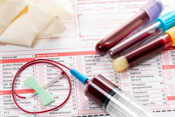 Exame de sangue, amostras de sangue em forma de laboratório — Fotografia de Stock