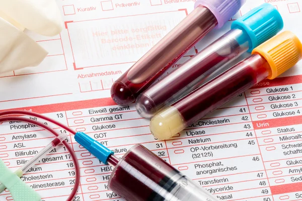 血液検査写真素材、ロイヤリティフリー血液検査画像|Depositphotos®