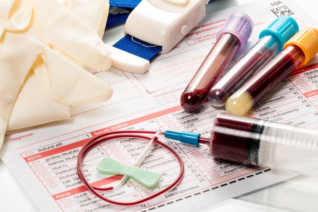 test, blood samples a laboratory form Stock Photo by ©fotoquique 112870730