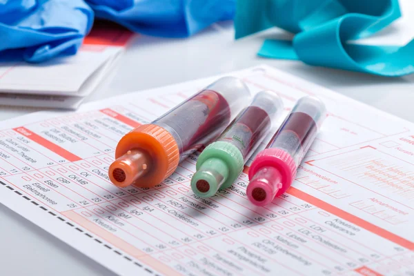 Análisis de sangre, muestras de sangre en forma de laboratorio — Foto de Stock