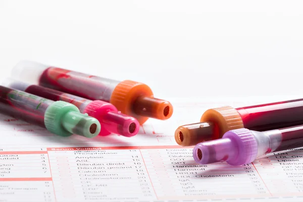 Análisis de sangre, muestras de sangre en forma de laboratorio —  Fotos de Stock
