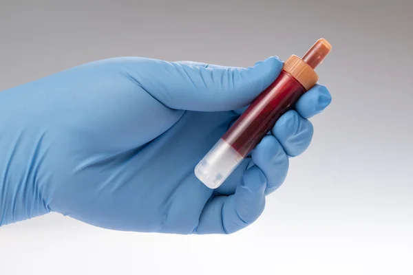 Blood test, blood samples — Stock Photo, Image