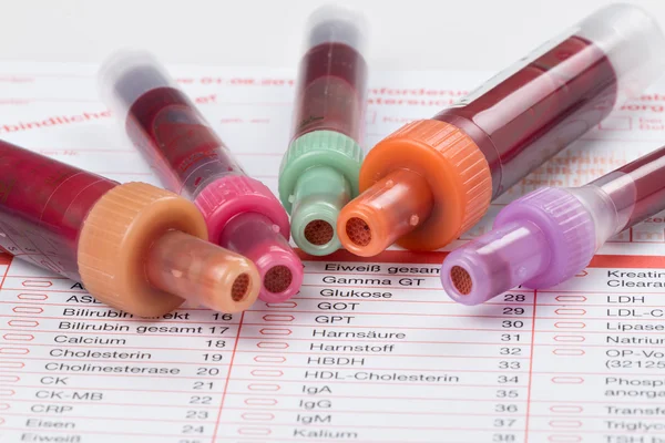 Blood test, blood samples on a laboratory form — Stock Photo, Image