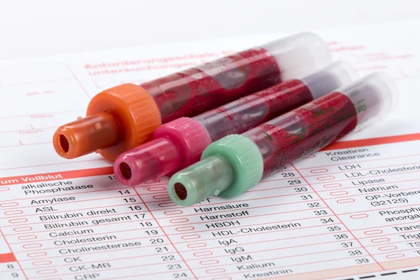 Análisis de sangre, muestras de sangre en forma de laboratorio — Foto de Stock