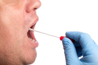 DNA testi, silme testi