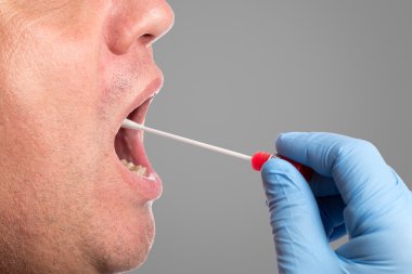 DNA testi, silme testi