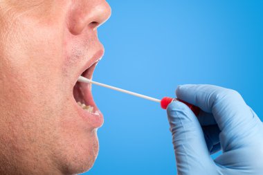 DNA testi, silme testi