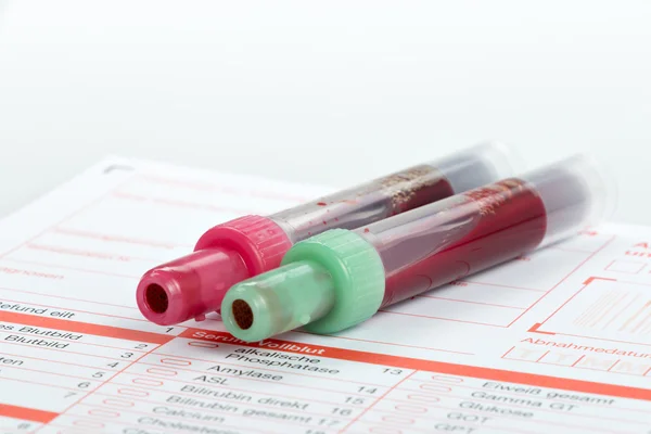 Análisis de sangre, muestras de sangre en forma de laboratorio — Foto de Stock