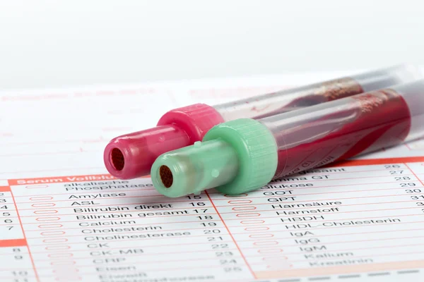 Badanie krwi, próbki krwi w formie laboratorium — Zdjęcie stockowe