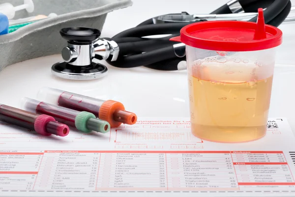 Urine- en bloedonderzoek (complete blood count) — Stockfoto