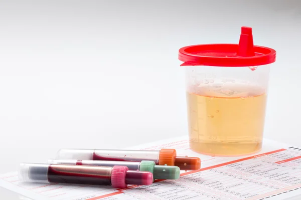 Urine and blood test (complete blood count) — Stock Photo, Image