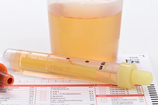 Urine and blood test (complete blood count) — Stock Photo, Image