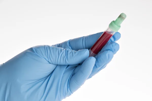 Test sanguin, échantillons de sang sur un formulaire de laboratoire — Photo