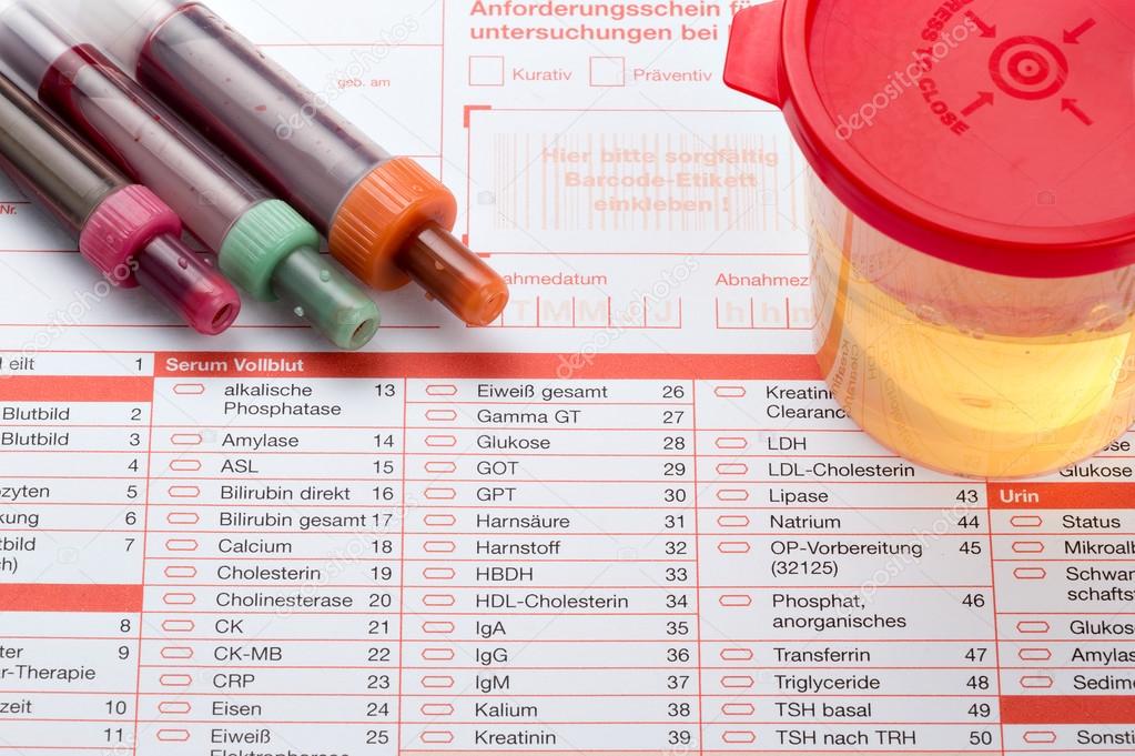 Análisis de orina y sangre (hemograma completo)) 2024