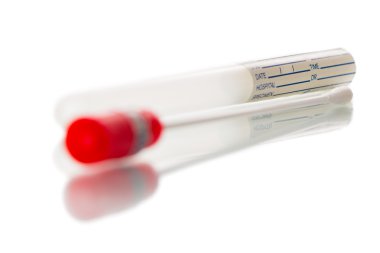 DNA testi, silme testi