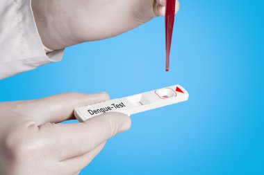 Doktor bir Dang test yapıyor