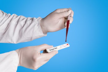 Doktor bir Dang test yapıyor