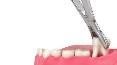 Diş macunları, tıbbi çekimde kıskaçlandı. Diş hizmetleri konsepti, beyaz renkte 3D.