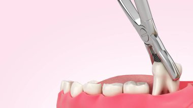 Diş hekimliği konseptinde sıkıştırılmış diş macunu renk eğimine göre 3D