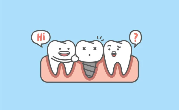 Beyaz Dişli Diş Karikatürü Gerçek Kök Implant Mavi Arka Planda — Stok Vektör