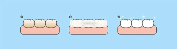 Passo Clareamento Dos Dentes Por Tiras Clareamento Dos Dentes Desenho — Vetor de Stock