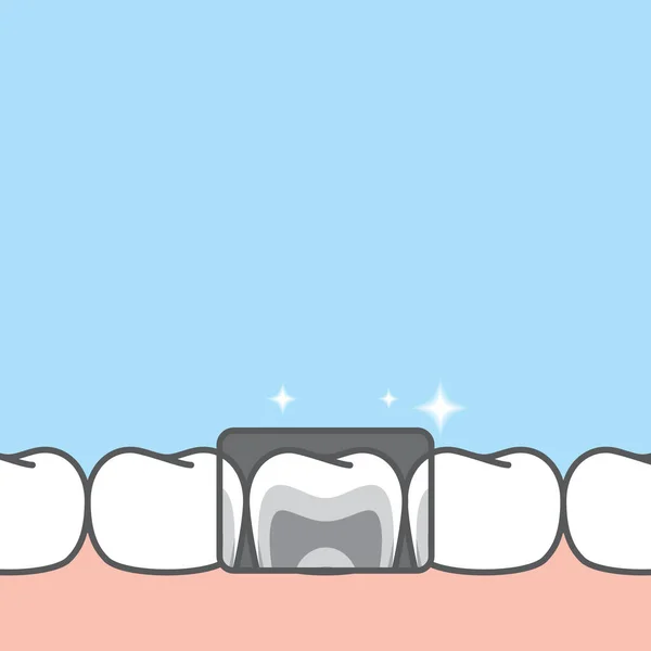 Banner Blanco Rayos Inferiores Dientes Higiene Saludable Ilustración Diseño Vectorial — Archivo Imágenes Vectoriales