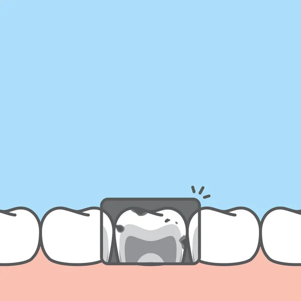 Banner Blanco Rayos Inferiores Poco Saludables Dientes Caries Antihigiénicos Ilustración — Archivo Imágenes Vectoriales