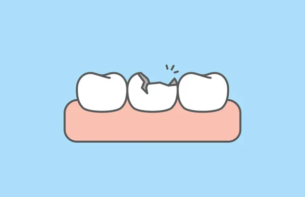 破碎的牙齿 白色的牙齿和牙龈说明向量设计蓝色背景 牙科护理概念 — 图库矢量图片