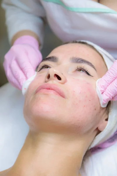 Una giovane donna viene eliminata dalle tracce di sangue da un'iniezione di plasma sul viso. — Foto Stock