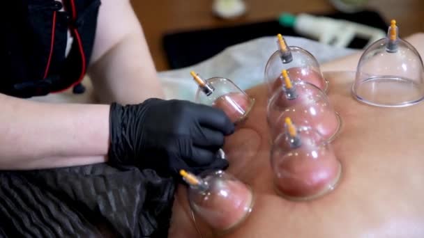 Een kaper meester maakt een incisie voor een jong meisje om bloed uit te zuigen.. — Stockvideo