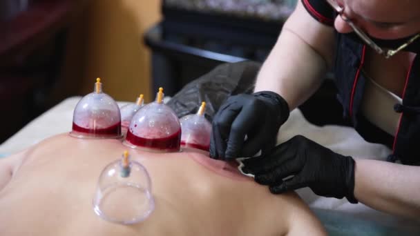 Un maestro de hijama hace una incisión para que una jovencita succione sangre. — Vídeos de Stock