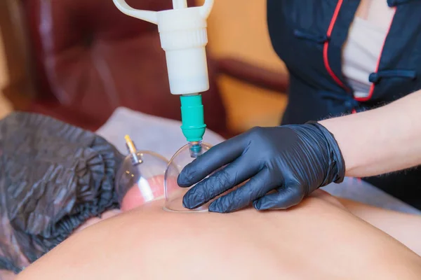 Un maestro hijama esegue una procedura di aspirazione del sangue sottovuoto per una giovane ragazza. — Foto Stock